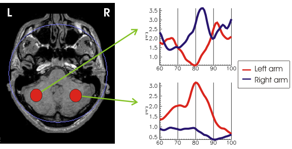Activity in cerebellar gracile