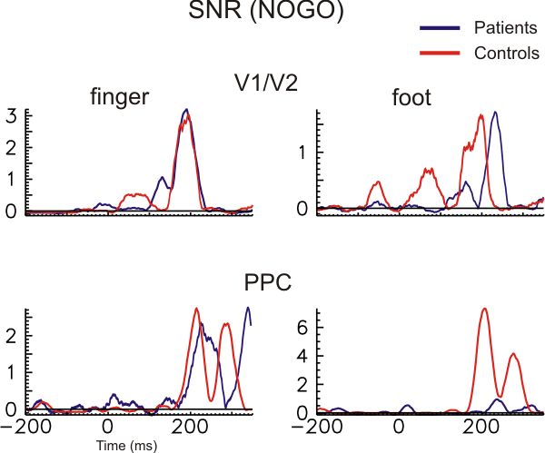 Paraplegic neural activity in V1 and PPC