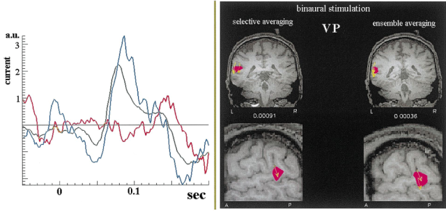 Single trial variability of auditory responses