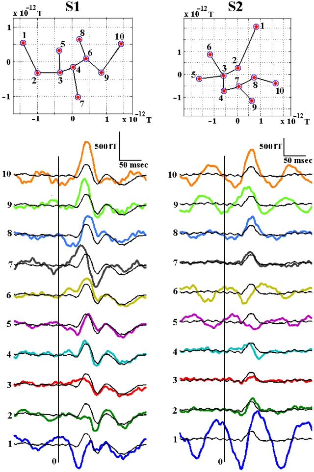 Single trial variability of M70
